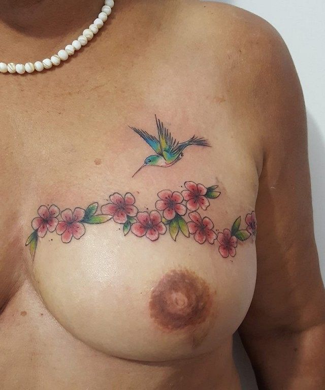 Tatuagem recupera autoestima da mulher após câncer de mama